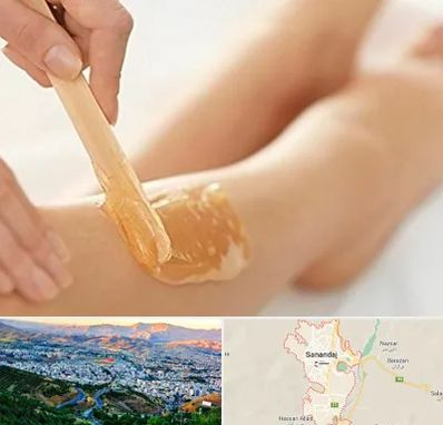 اپیلاسیون بدن در سنندج