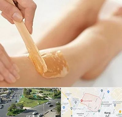 اپیلاسیون بدن در شاهین ویلا کرج