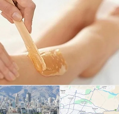 اپیلاسیون بدن در شمال شرق تهران