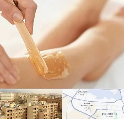 اپیلاسیون بدن در جنوب غرب تهران