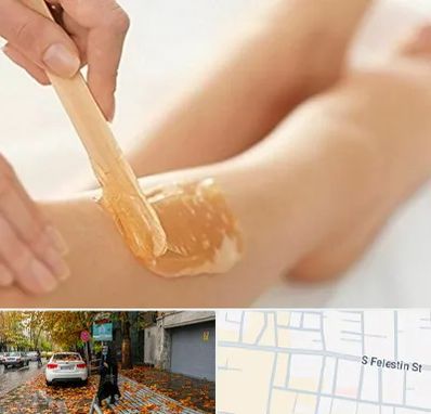 اپیلاسیون بدن در خیابان فلسطین