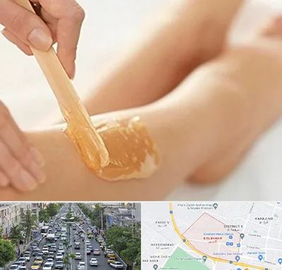 اپیلاسیون بدن در گلشهر کرج