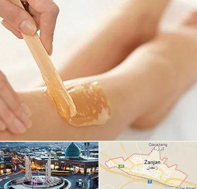 اپیلاسیون بدن در زنجان