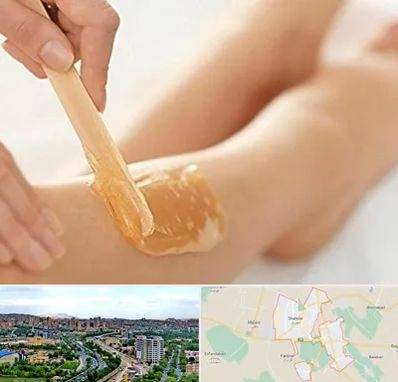 اپیلاسیون بدن در شهریار