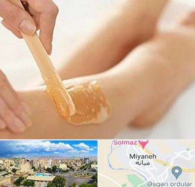 اپیلاسیون بدن در میانه