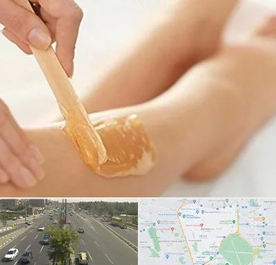 اپیلاسیون بدن در منطقه 17 تهران 