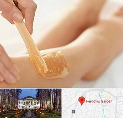 اپیلاسیون بدن در باغ فردوس