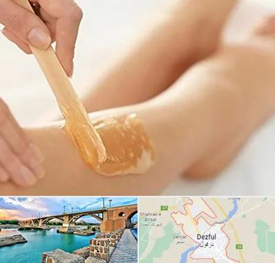 اپیلاسیون بدن در دزفول