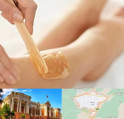 اپیلاسیون بدن در خوی