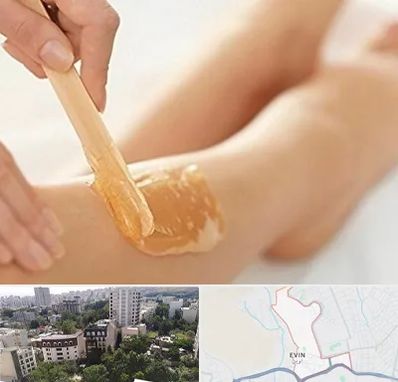 اپیلاسیون بدن در اوین