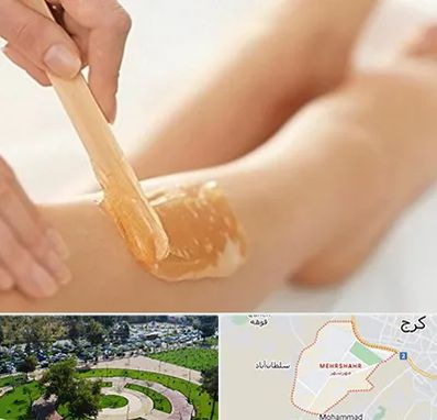 اپیلاسیون بدن در مهرشهر کرج 