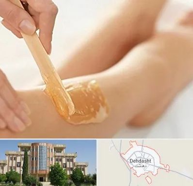 اپیلاسیون بدن در دهدشت