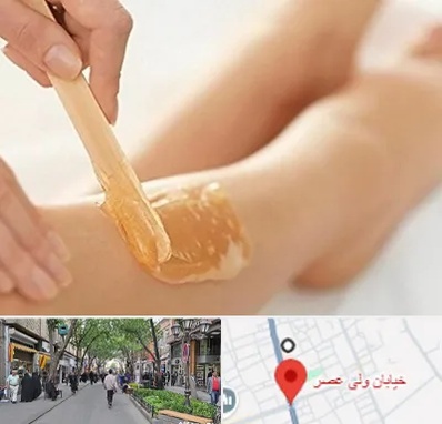 اپیلاسیون بدن در ولیعصر شهریار