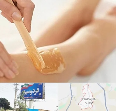 اپیلاسیون بدن در فردوسیه شهریار