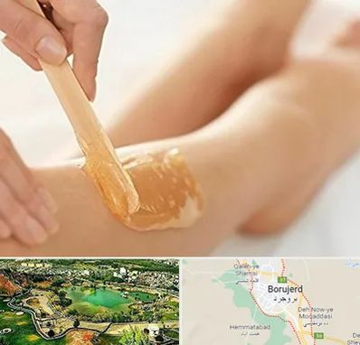 اپیلاسیون بدن در بروجرد