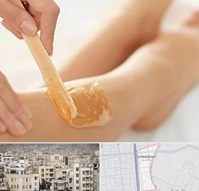 اپیلاسیون بدن در اسکندری