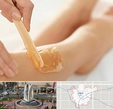 اپیلاسیون بدن در زابل