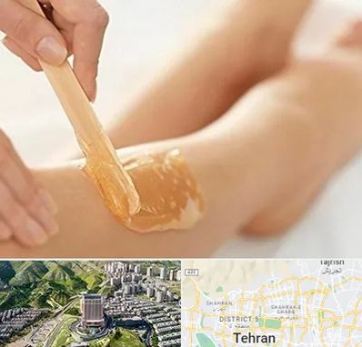 اپیلاسیون بدن در شمال تهران 
