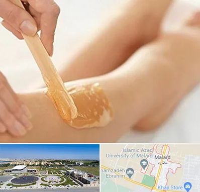 اپیلاسیون بدن در ملارد