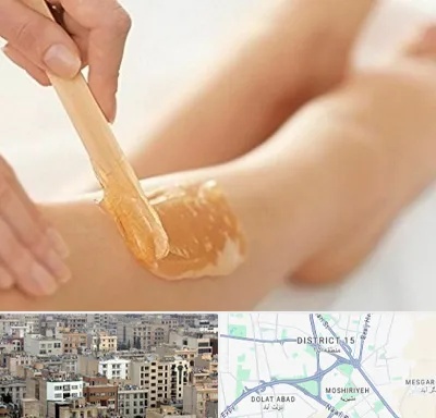 اپیلاسیون بدن در جنوب شرق تهران