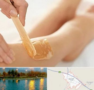 اپیلاسیون بدن در قروه