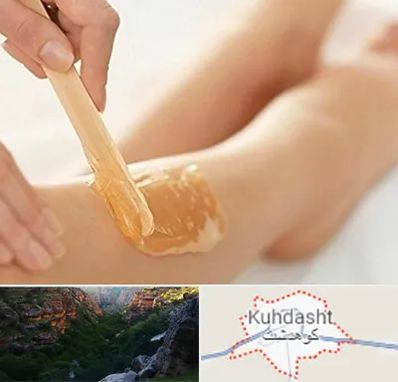 اپیلاسیون بدن در کوهدشت
