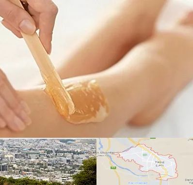 اپیلاسیون بدن در یاسوج