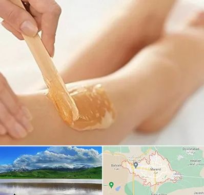 اپیلاسیون بدن در مرند