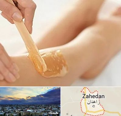 اپیلاسیون بدن در زاهدان