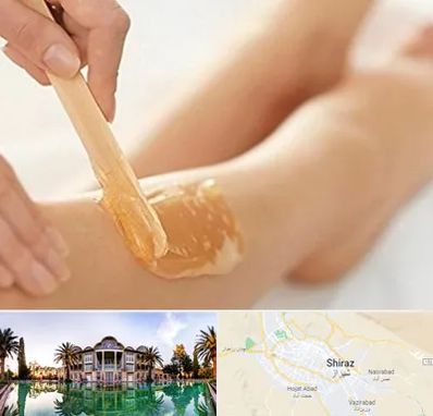 اپیلاسیون بدن در شیراز