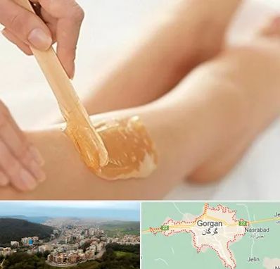اپیلاسیون بدن در گرگان