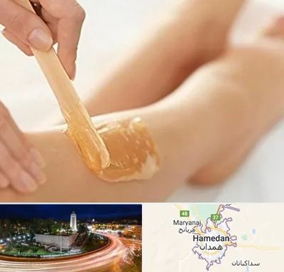 اپیلاسیون بدن در همدان