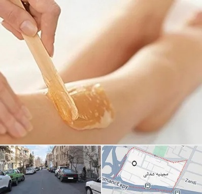 اپیلاسیون بدن در مجیدیه شمالی