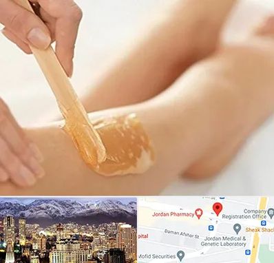 اپیلاسیون بدن در جردن 