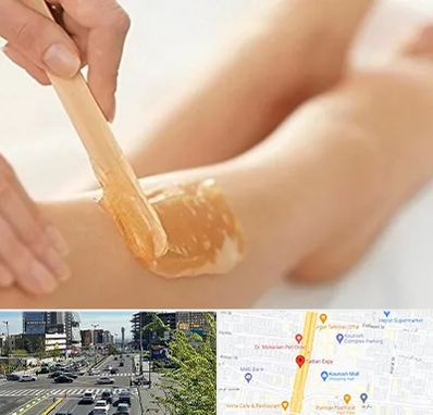 اپیلاسیون بدن در ستاری 