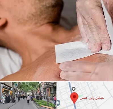 اپیلاسیون آقایان در ولیعصر شهریار