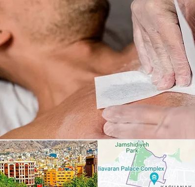 اپیلاسیون آقایان در نیاوران 