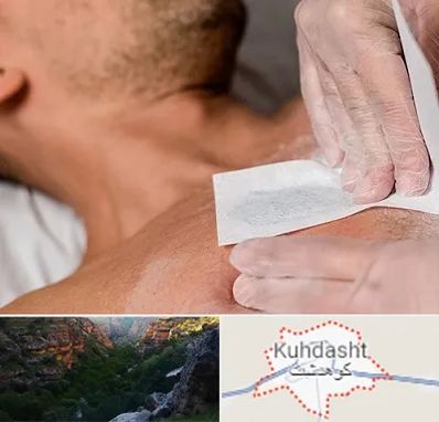 اپیلاسیون آقایان در کوهدشت