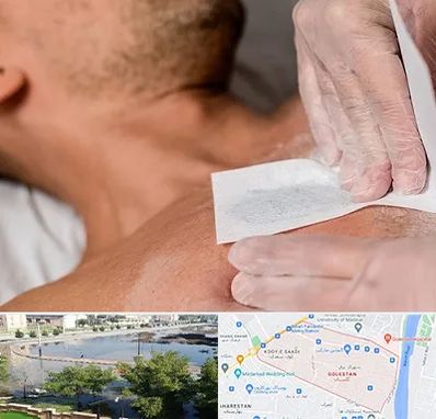 اپیلاسیون آقایان در گلستان اهواز