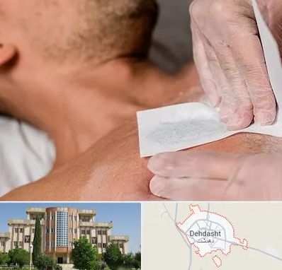 اپیلاسیون آقایان در دهدشت