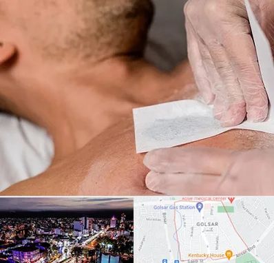 اپیلاسیون آقایان در گلسار رشت 