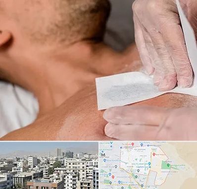 اپیلاسیون آقایان در منطقه 14 تهران 