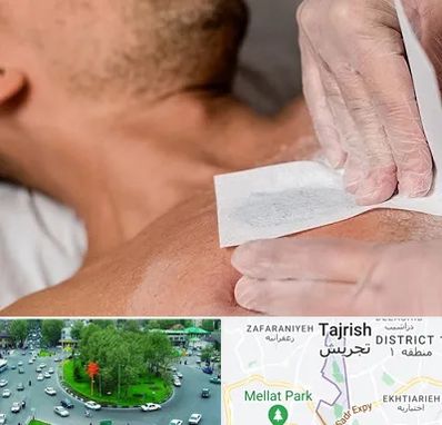 اپیلاسیون آقایان در تجریش 