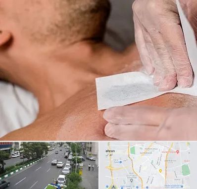 اپیلاسیون آقایان در ستارخان 