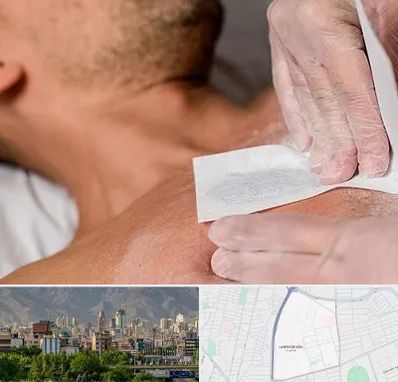 اپیلاسیون آقایان در جمشیدیه