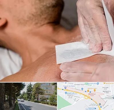 اپیلاسیون آقایان در مهرویلا کرج