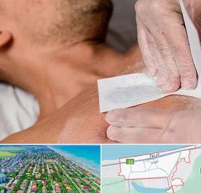 اپیلاسیون آقایان در نور