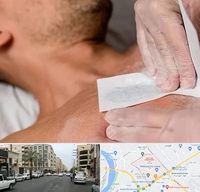 اپیلاسیون آقایان در زیتون کارمندی اهواز