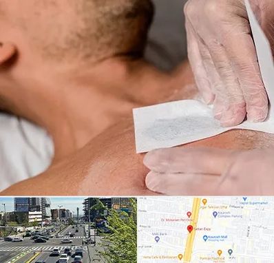 اپیلاسیون آقایان در ستاری 