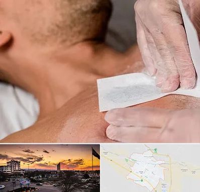 اپیلاسیون آقایان در قوچان